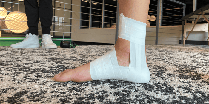 PTs use taping to treat inside of ankle pain caused by Posterior Tibial Tendonitis (PTTD)